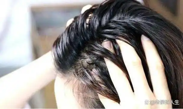 床上螨虫成堆1个笨招屋里摆个它螨虫跑光