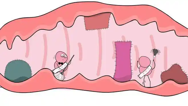 外阴炎的种类有哪些