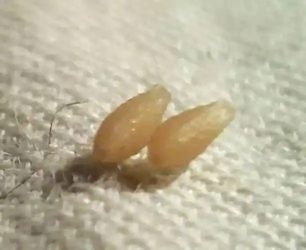 绦虫节片:形如米粒.你不能管它叫卵,这其实是绦虫身体的一部分.