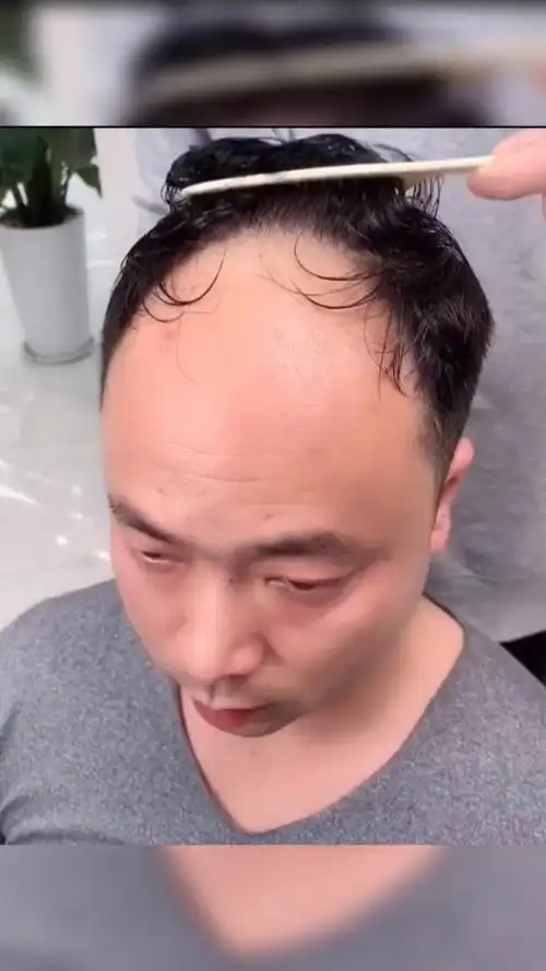 油腻大叔秃顶遭媳妇嫌弃,终于忍不住从惠阳赶过来定制假发,你们说他能