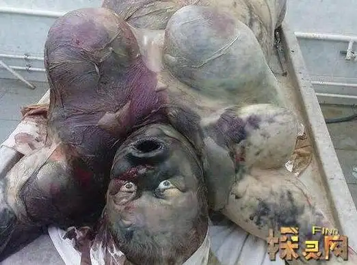 人死后,由于生命过程的终止,使得那些在生活状态时就寄生在人体内的