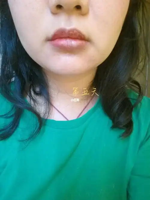 纹唇第四天第五天