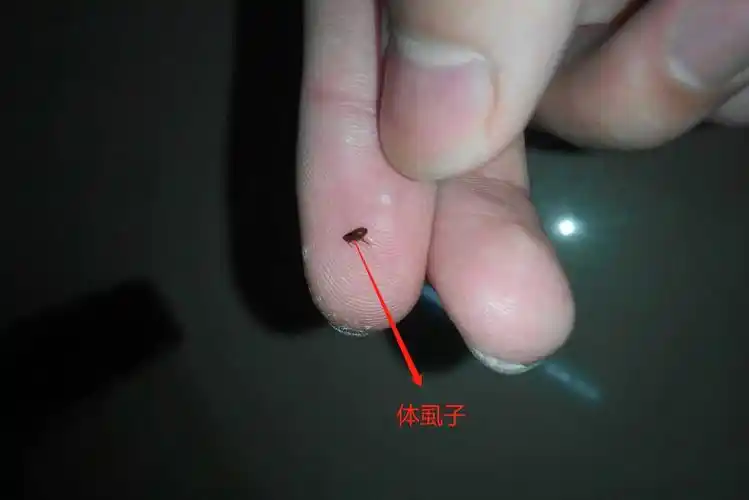 体虱子
