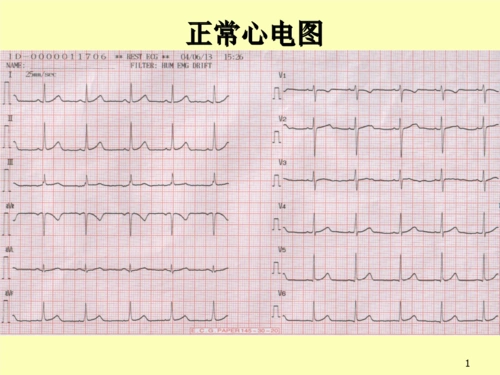 经典心电图实用手册【实用查询 快速记忆】.ppt