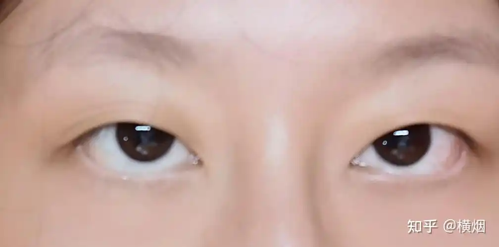 拥有一双三白眼是怎样的体验