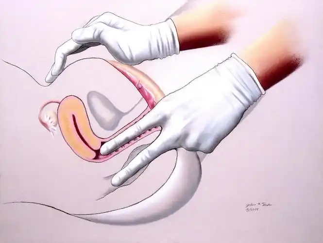 盆腔直肠阴道检查