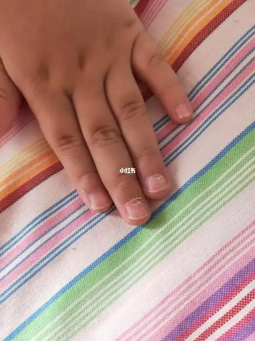 宝宝两周八个月指甲分层怎么回事?求大神!