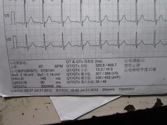 心电轴轻中度右偏_百度知道