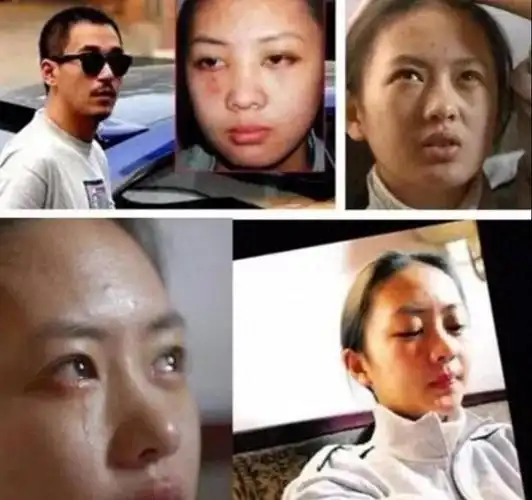 2003年秋天的一天,中央戏剧学院的学生张默在校门口殴打了自己的女