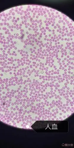 人血教学玻片