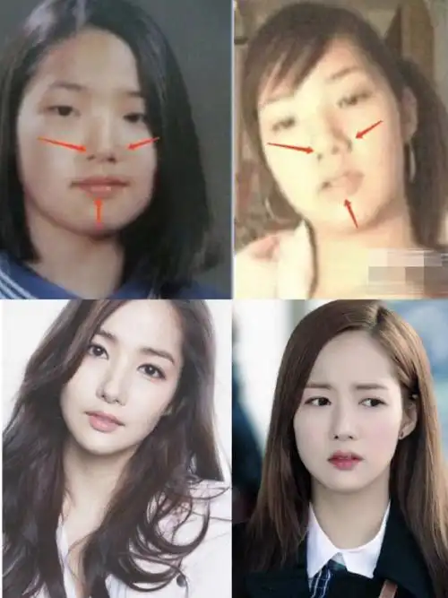 要知道朴敏英的颜值不是天生的而是后天的整容使她蜕变成一个大美女的