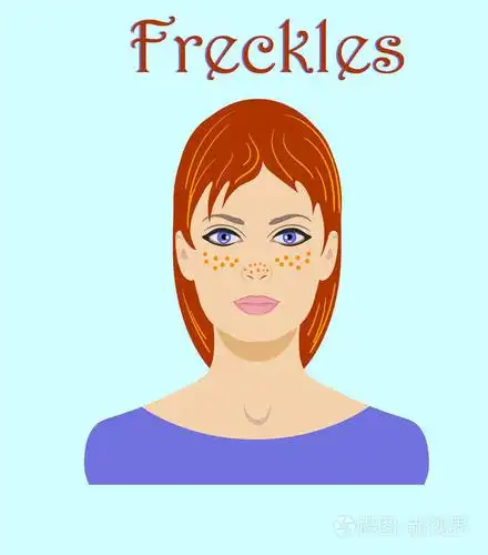 可爱的雀斑 redhaired 年轻女子头像在蓝色背景下隔离