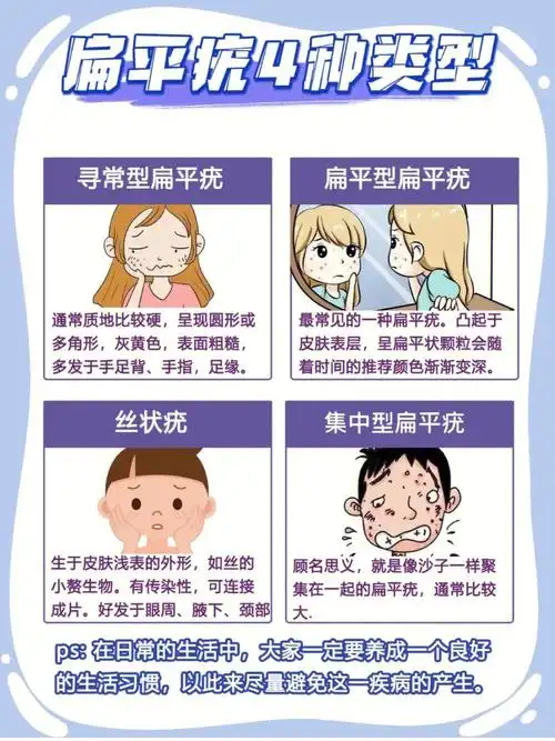 扁平疣,不可小觑的皮肤病,扁平疣是皮肤科非常常见的一种疾病,几乎