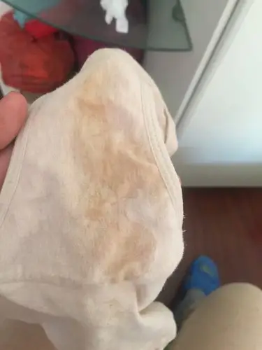 40 1上厕所时流了好大一坨粘液,淡黄色的,不知道是不是宫颈粘液?