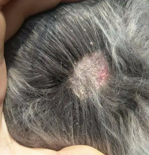 请问我家狗得的这是皮肤病么