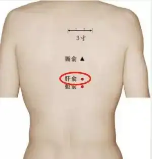 脂肪肝是逆转,还是癌变?就看能否抓住这5个关键点!