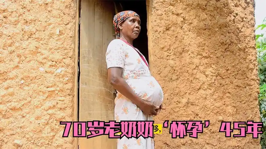 非洲70岁老婆婆,怀孕45年.一直挺着大肚子