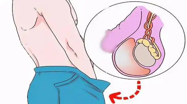 蛋蛋,其实就是医学上说的睾丸.