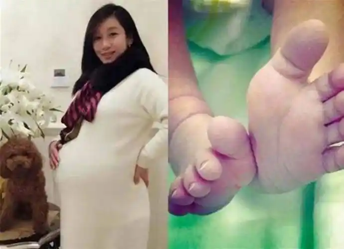 秦海璐37岁生下"巨婴症"儿子,躲过了高龄产子,却躲不过遗传