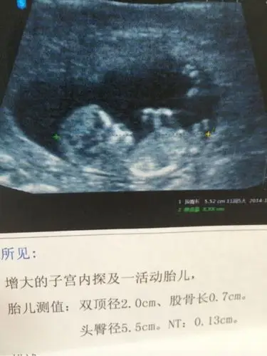 100%生女儿的症状,生男孩的症状