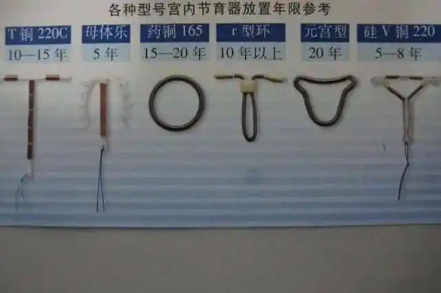 30年过去了,第一批"上环"的妈妈们怎么样了?现状令人心疼