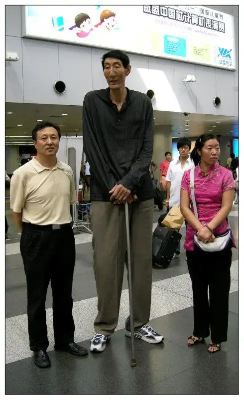 中国第一巨人鲍喜顺:57岁结婚,婚后一年有了孩子