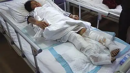 59岁农妇拒给丈夫买酒钱 被其用钢筋暴打或截肢