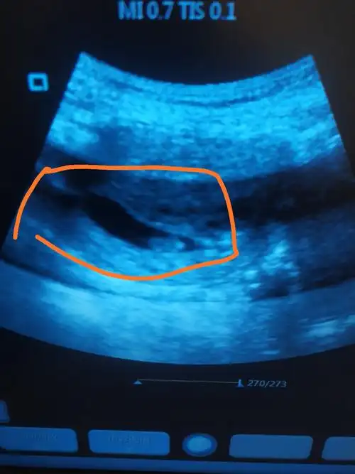 虎宝快快来:男孩吧2021年9月妈妈网_plees2021年3月回复(0)点赞(0)11