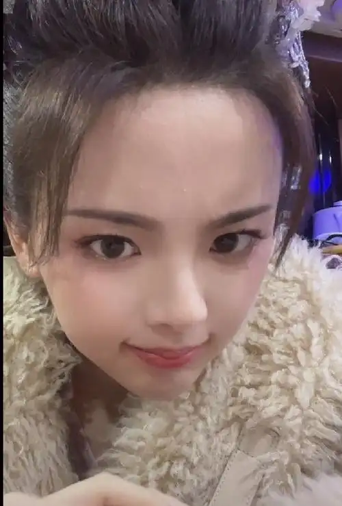 杨超越罕见晒素颜照额头上长满痘痘丝毫没有偶像包袱