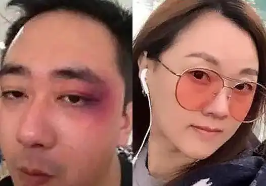 被妻子扇500记耳光,6次烟头烫伤,8次进医院,王自健现状如何?