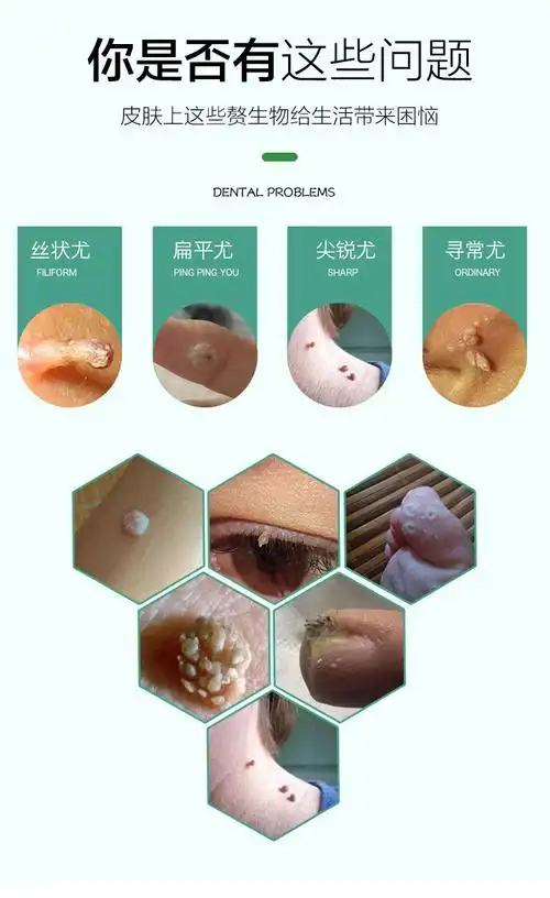 药监局提示您:请正确认识化妆品功效,化妆品不能替代药品,不能治疗皮