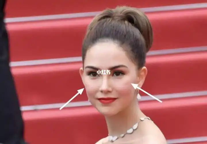 和昆凌一样的印第安纹剥离的怎么样