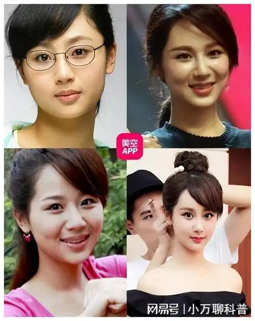 "整容后遗症"的回旋镖,还是扎到了金晨,杨幂的身上|杨紫|唐嫣|刘涛|女