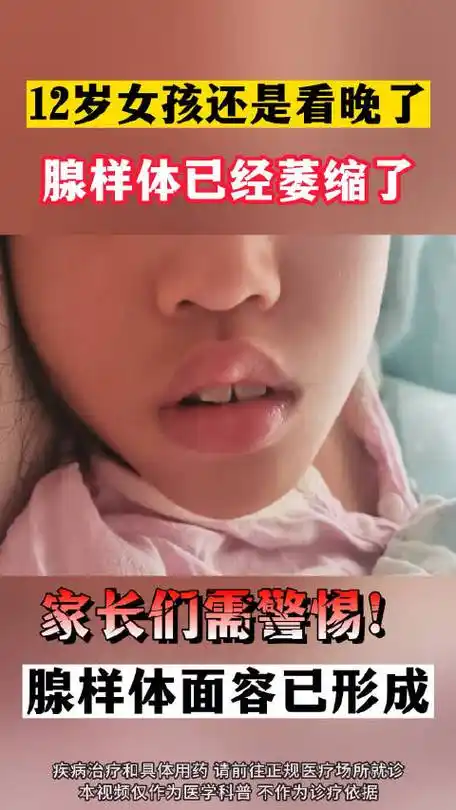 国医的精诚力量##儿童健康守护者计划##腺样体肥大