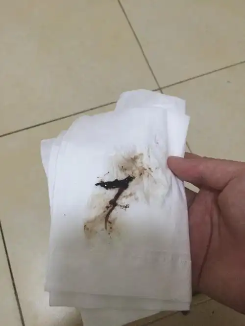 排卵期同房一天后出现咖啡色的血迹,开始以为是月经提前来了,后来连