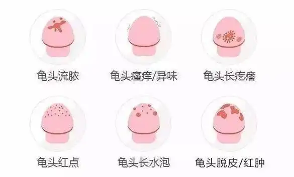 龟头周围长一些小疙瘩是怎么回事?是性病吗?