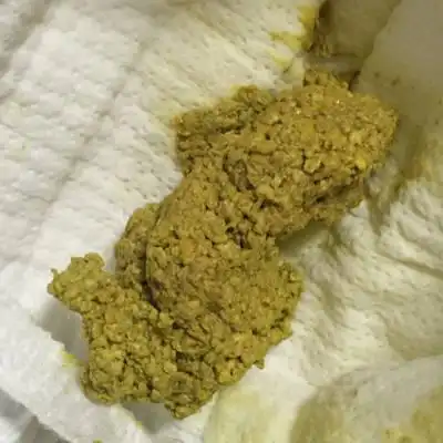 各位有经验的宝妈,帮我看下大便这样一颗颗的,是奶瓣吗还是消化不良?