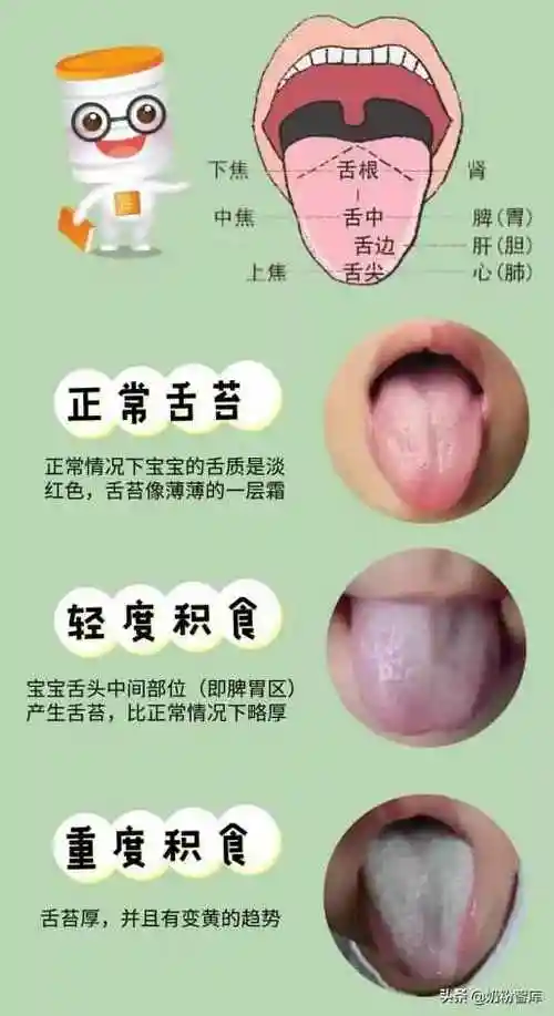 舌苔厚白口臭怎么治舌苔发白口中粘腻口臭