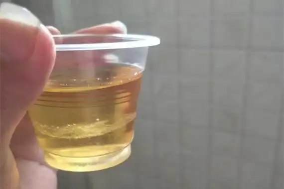 晨尿加盐测男女图怀孕一个月用盐测男女