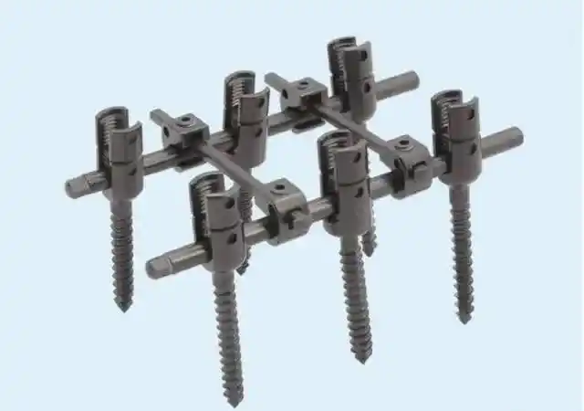 椎弓根螺钉内固定物(俗称"打钉子") 什么是"打钉子"?