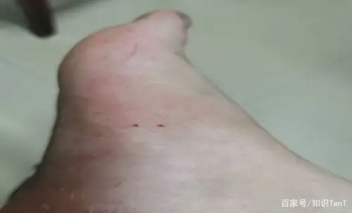 一口就能咬死成人!中国最毒的毒蛇,银环蛇有多恐怖?