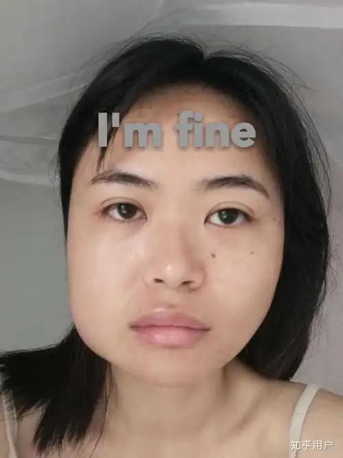 脸型极度不对称是什么体验?