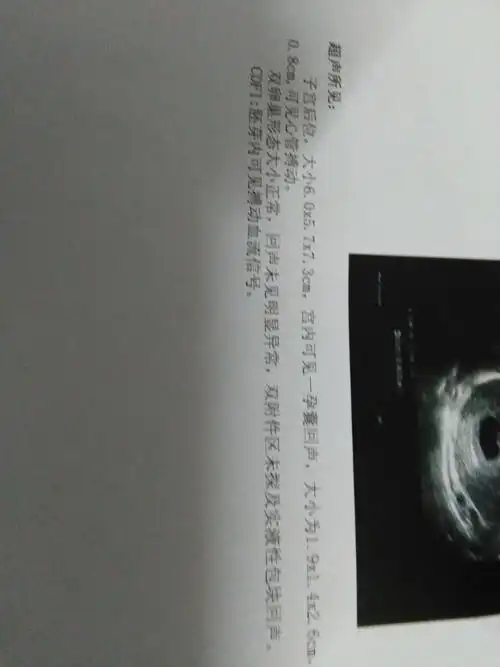 孕6周 ,孕囊大小为1.9x1.4.2.6cm,请问这是男胎还是女胎呀?