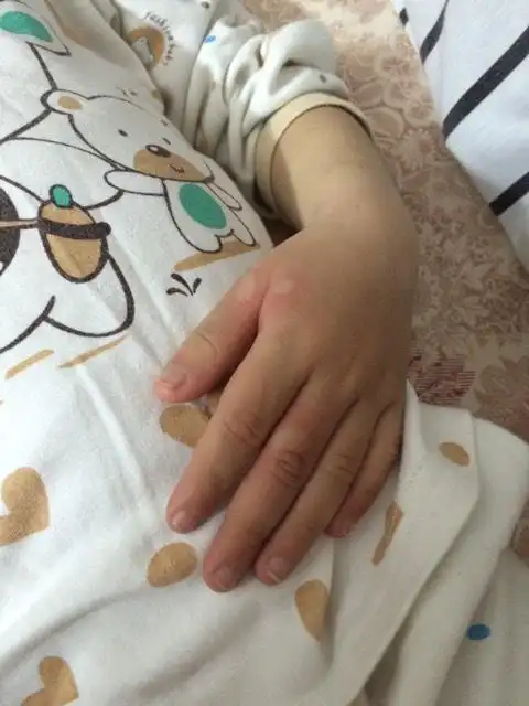 蚊子好多啊……宝宝被叮得可怜