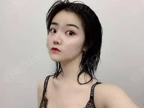 上海华美谢卫国院长特贝茨假体隆胸对自己变大的胸部我都有点爱不释手