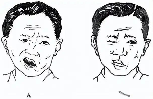 「大家说科普」脑血管病的症状识别和防治(一)