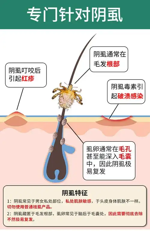 阴虱男私处用10硫磺软膏去虱子乳膏百部酊喷雾林ld旦乳膏孕妇女用祛除