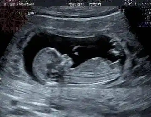 41岁的selina怀孕,b超透露胎儿性别,而比她大7岁男友却态度冷淡_孩子