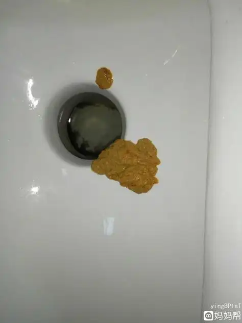 大便老是拉稀怎么回事(天天上厕所拉稀怎么回事)_竞价网