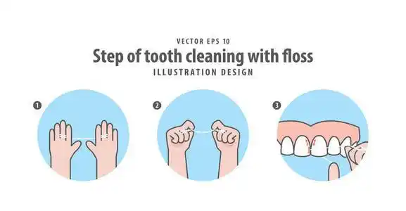 用牙线图解矢量在蓝 ba 上清洗牙的步骤照片